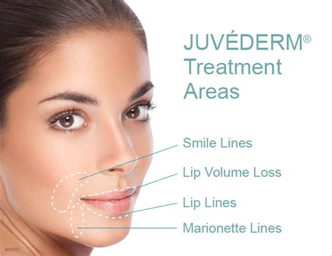 JuvÉderm And Voluma Xc In Atlanta Buckhead Facial Plastic Surgery
