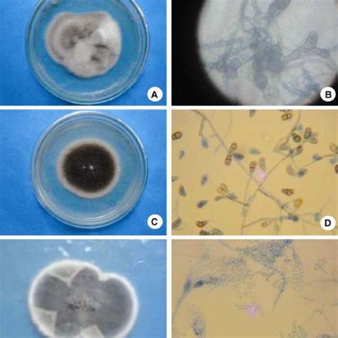 Macroscopic And Microscopic Colony Morphologies Of The Endophytic Fungi