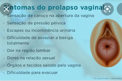 Prolapso Uterino BabyCenter