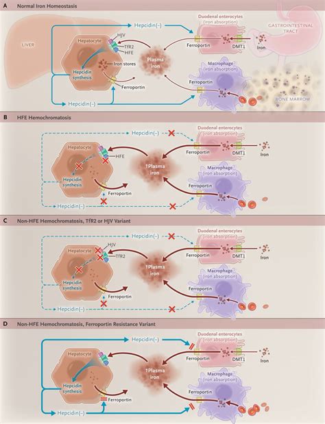 Keith Siau On Twitter Haemochromatosis Pathophysiology And Clinical