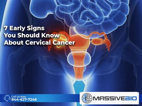 7 Early Signs You Should Know About Cervical Cancer Massive Bio