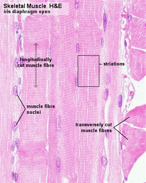 Our bodies are composed of over 650 muscles, which is divided into 3 major categories: Edit Photo | Skeletal muscle, Muscle, Human anatomy and ...