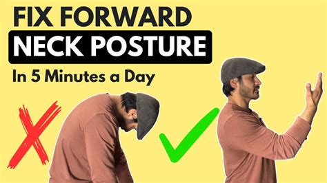 Fix Forward Neck Posture Part 1 Youtube