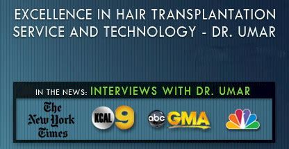 No stitches and minimal discomfort! Dr. Umar Hair Transplant | HairSite.com