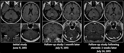 Robin smithuis and henk jan van der woude. May 11, 2015 - Case of the Week | American Journal of ...