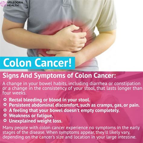 Colon Cancer Causes Symptoms And Treatment Veledora Health