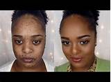 How To Cover Brown Spots On Face With Makeup Images