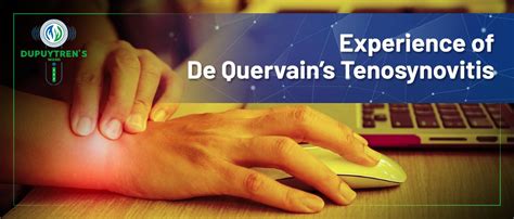 The Reality Of De Quervains Tenosynovitis What It Is Like Living