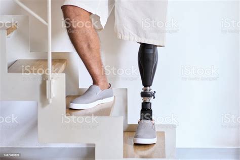 Amputee Man With Above Knee Leg Prosthesis Standing On Feet Close Up