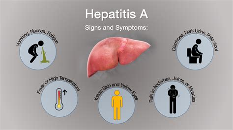 Hepatitis A Symptoms Causes And Treatment Scientific Animations