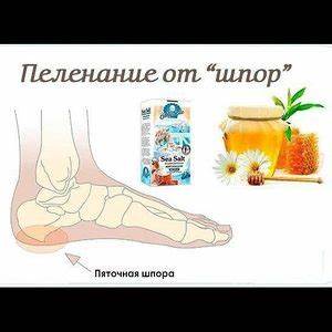 Диета есть от шпор