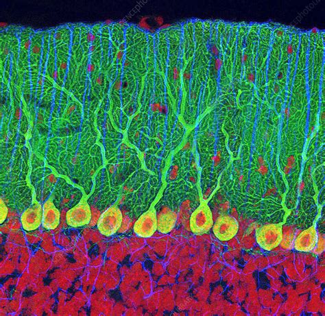 Purkinje Nerve Cells In The Cerebellum Stock Image P3600474
