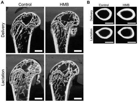 Representative µct Images Of Sagittal Sections Of The Femur Distal