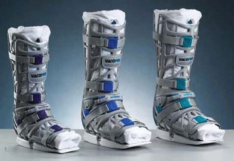 Einen achillessehnenriss kann man zum einen nach der ursache unterscheiden, zum anderen nach der von der schiene zum spezialschuh. The vacuum orthesis (Vacoped ® ) with the possible ROM ...