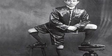The Story Of Francesco Lentini The Man Who Lived With Three Legs And
