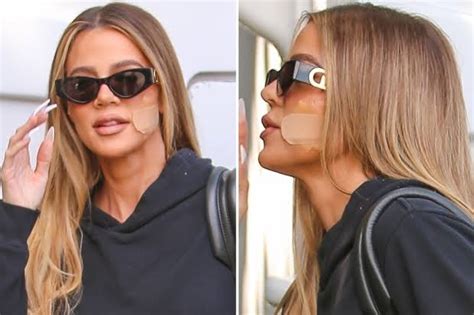 khloe kardashian undergoes surgery to remove tumor from her face eelive