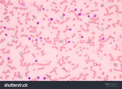 Human Blood Smear View Microscopycomplete Blood Stock Photo 1626697159