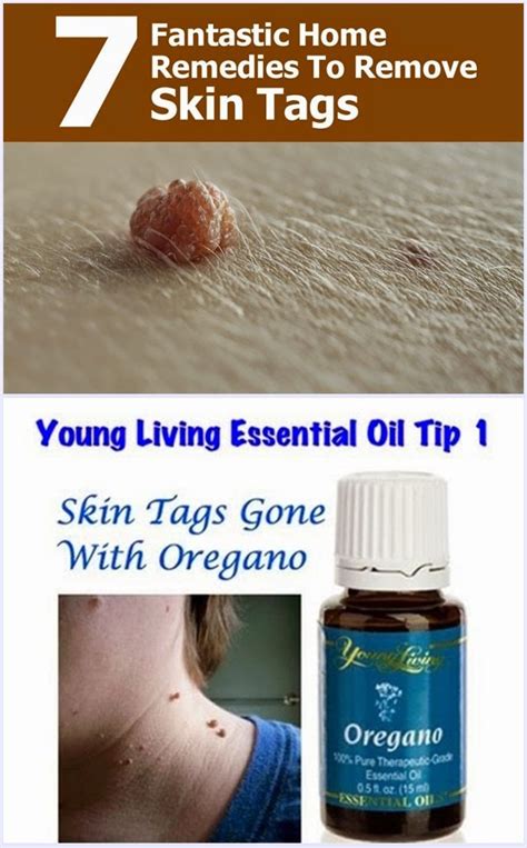 7 fantastic home remedies to remove skin tags essential oils for skin skin tag removal skin tag
