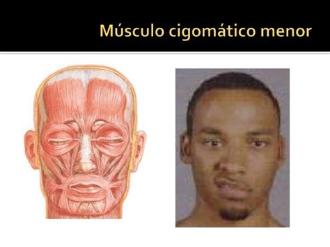 Músculos De La Expresión Facial