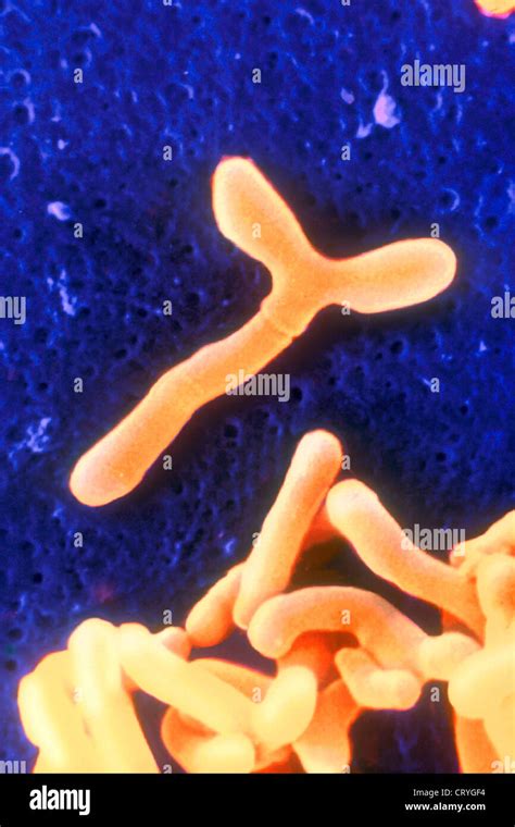 Bifidobacteriales Fotografías E Imágenes De Alta Resolución Alamy