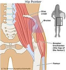 Gluteus Medius Pain At Iliac Crest