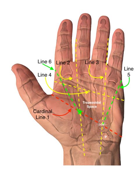 Surface Anatomy Hand Surgery Source