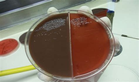 Crecimiento De Streptococcus En Agar Sangre Y Agar Chocolate