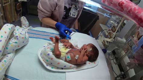 Premature Baby Born At 27 Weeks And 5 Days Now 31 Days Old 3lb 1oz Youtube