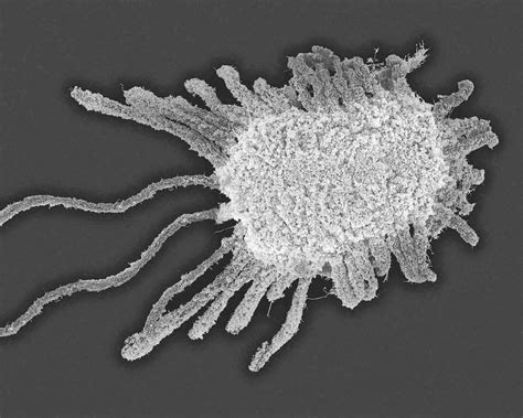 Whitefly Larva Photograph By Dennis Kunkel Microscopyscience Photo
