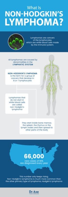 Non Hodgkins Lymphoma Natural Symptom Management Dr Axe