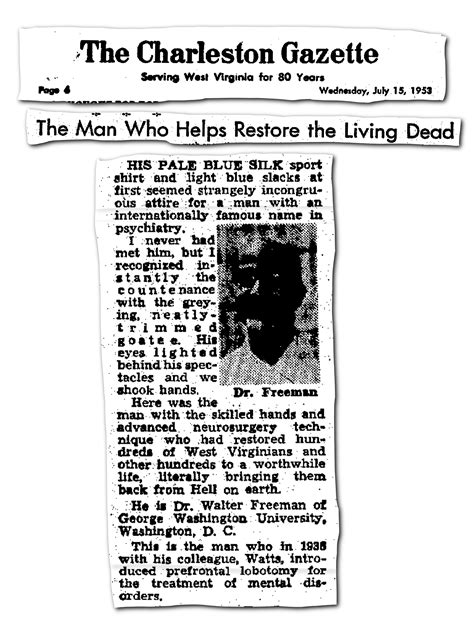 Famous Lobotomy Patients