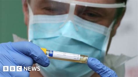 Coronavirus Cases Rise By 18 In Scotland