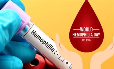 World Haemophilia Day 2022 Haemophilia Symptoms Warning Signs Get To