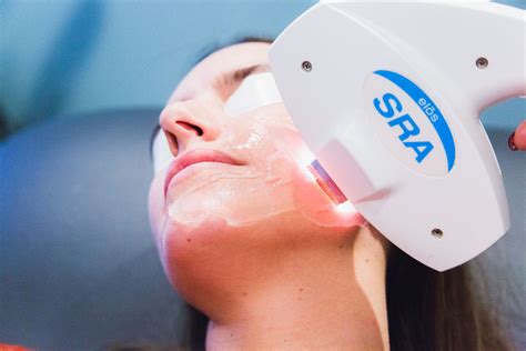 Best Skin Resurfacing Treatment In Cincinnati All About Co2 Laser
