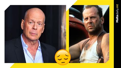 Actor Bruce Willis Diagnosed With Frontotemporal Dementia