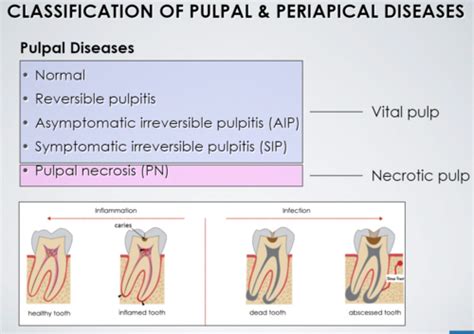 Lecture Classification Of Pulpal Periapical Diseases Intro To Endo