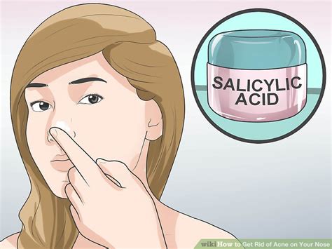What does it mean when you have pimples on your nose? 4 Ways to Get Rid of Acne on Your Nose - wikiHow