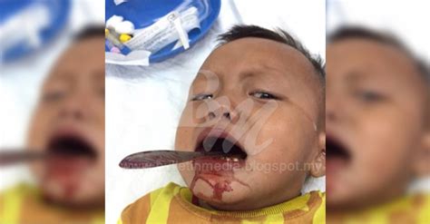 Malang tak berbau =kecelakaan tidak dapat. GEMPAR !! :Malang Tidak Berbau !!! Garpu Tercucuk Dalam ...