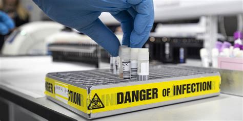 The kit is called coviself and has been seen working on symptomatic covid positive patients. FDA Approves First At Home Coronavirus Testing Kit ...