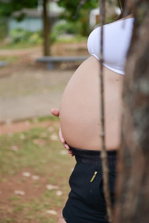 Engravidei Após Ter Feito Cirurgia Plástica E Agora Dra Denise Gomes Mamae Plena