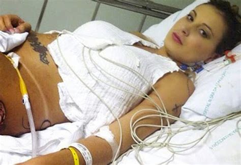 Plastic Surgery Goes Horribly Wrong For Miss Bumbum Graphic