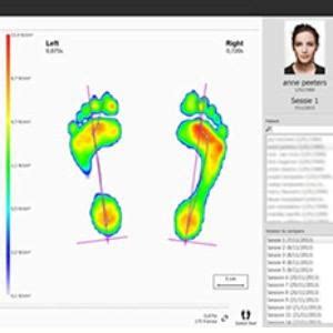 Gait Analysis And Foot Orthotics Cherie Viljoen Podiatrist