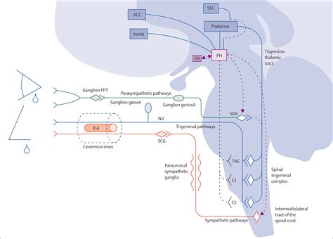 Pathophysiology Of Trigeminal Autonomic Cephalalgias The Lancet Neurology