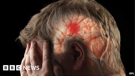 Nhs Continues To Miss Stroke Admittance Target Bbc News
