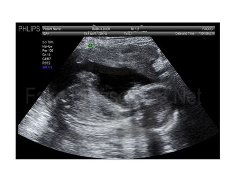 Fake Ultrasounds That Look Real! - FakeUltrasounds.Net