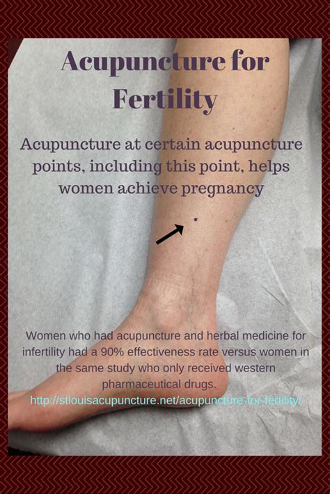 Acupuncture Points For Male Infertility