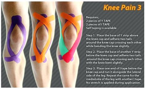 How To Apply Kt Tape To Knee Leg Santa Barbara Deep Tissue Riktr Pro Massage Nicola Lmt