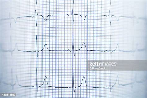 Electrocardiogram Printout Photos And Premium High Res Pictures Getty