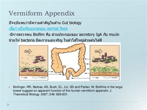Rupture Appendicitis