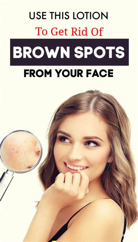 How To Remove Brown Spots On Face Obviously Handsomemen